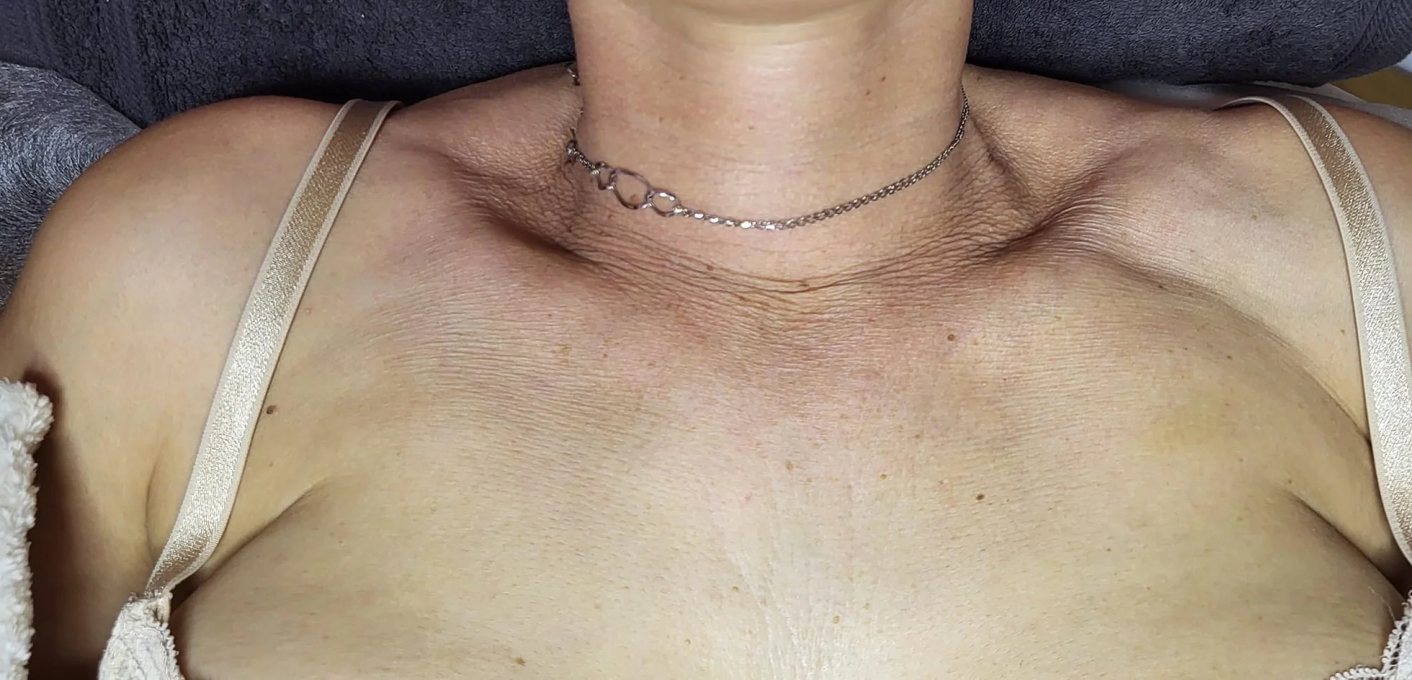 Mikrojehličkování nebo karbonový peeling pro omlazení a obnovu pleti