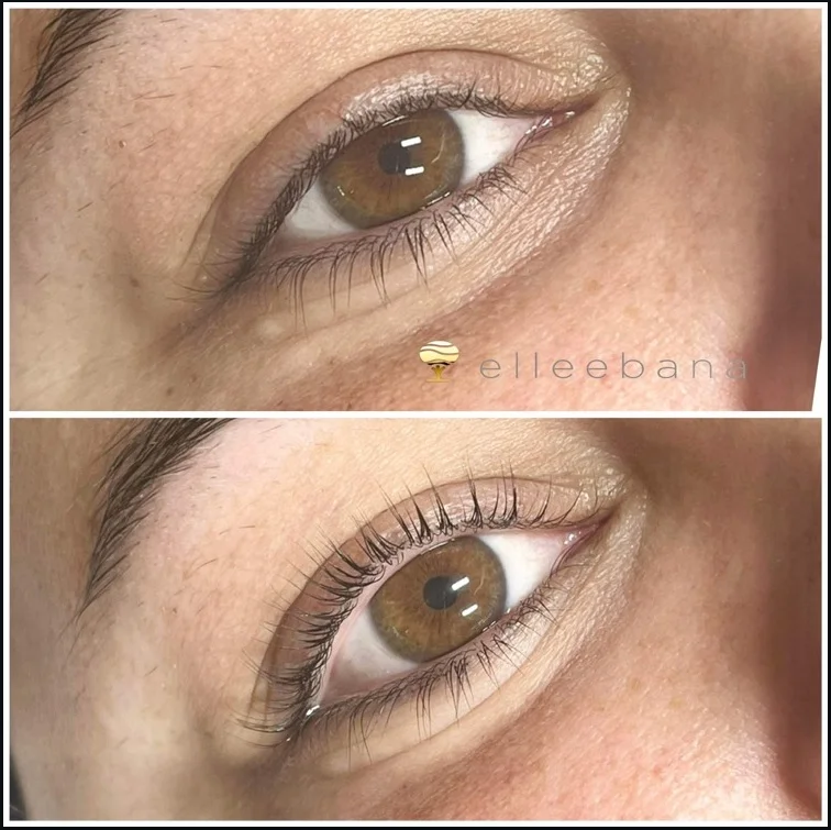 Omlazení pleti: liftingová masáž nebo relaxační kosmetika a k tomu extra procedura