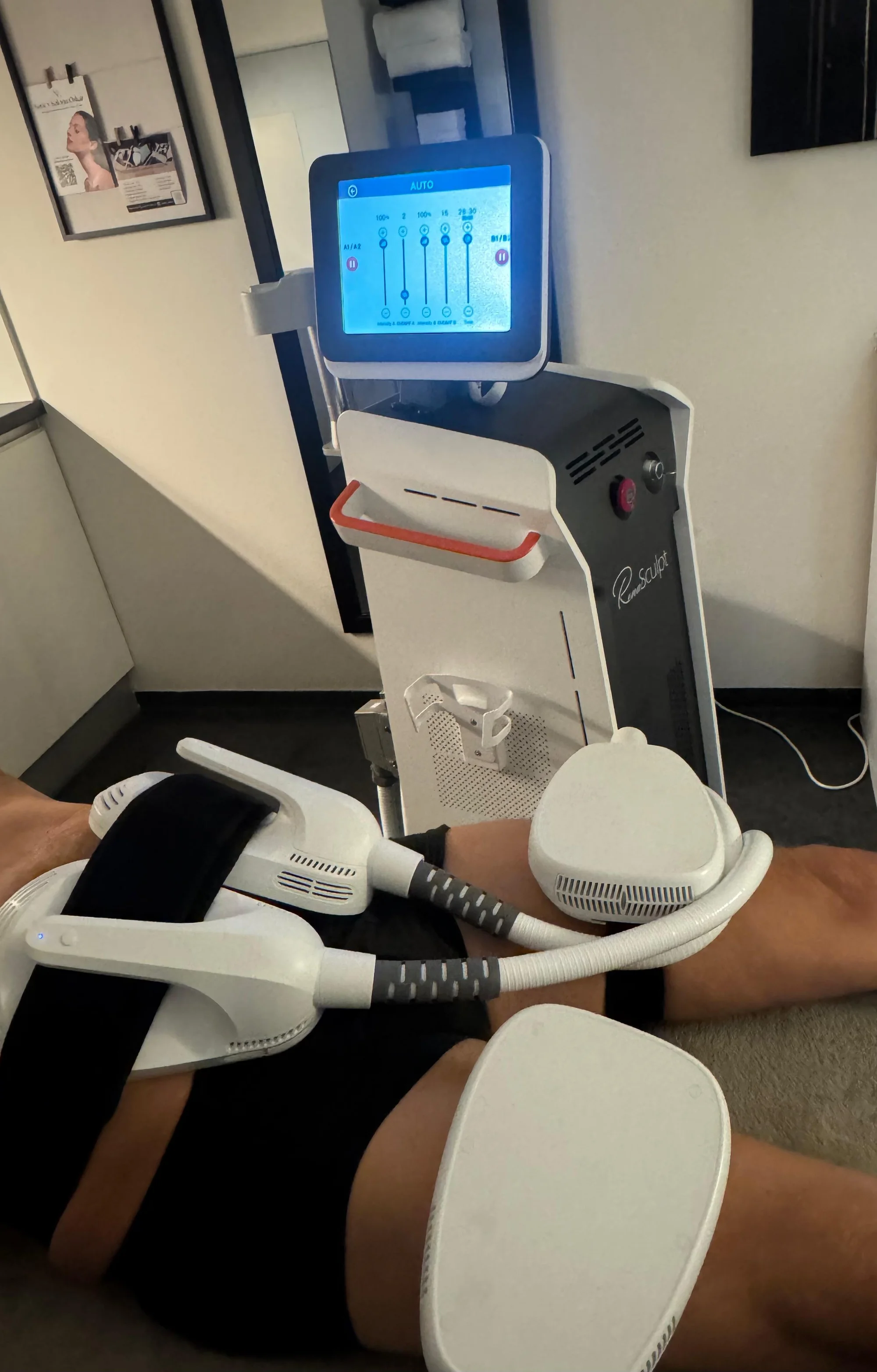 EMS ošetření a posílení pánevního dna: efektivní cesta k pevnější postavě