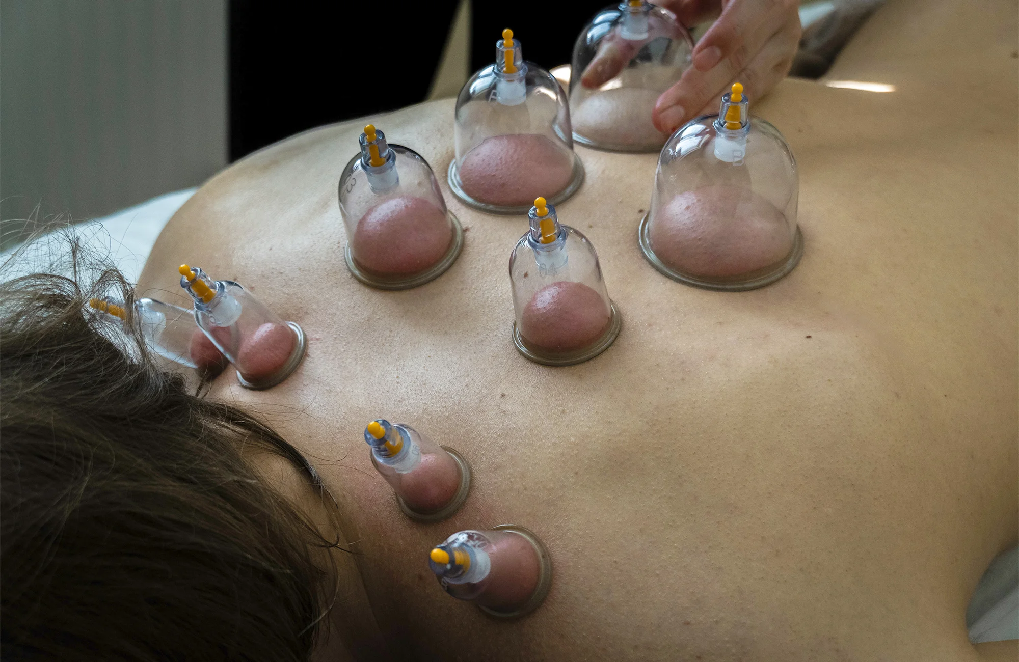 Masáž zad a šíje vč. baňkování: úleva a regenerace během 40 minut