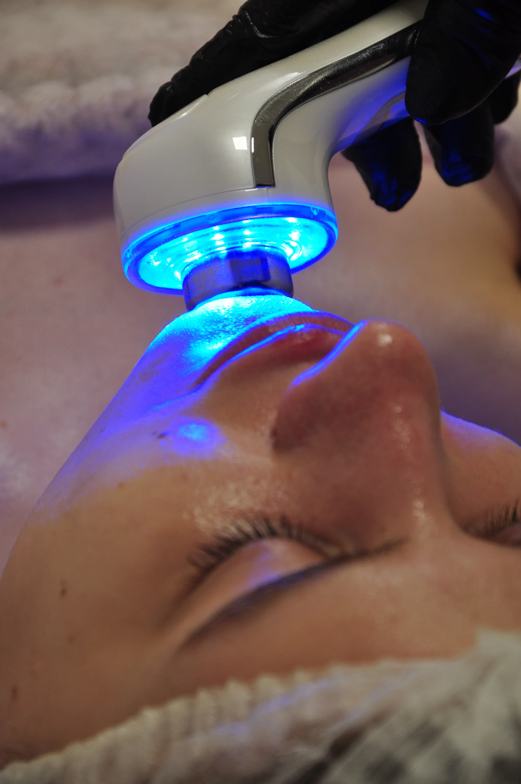 Krásná pleť: chemický peeling s AHA kyselinami v centru Brna