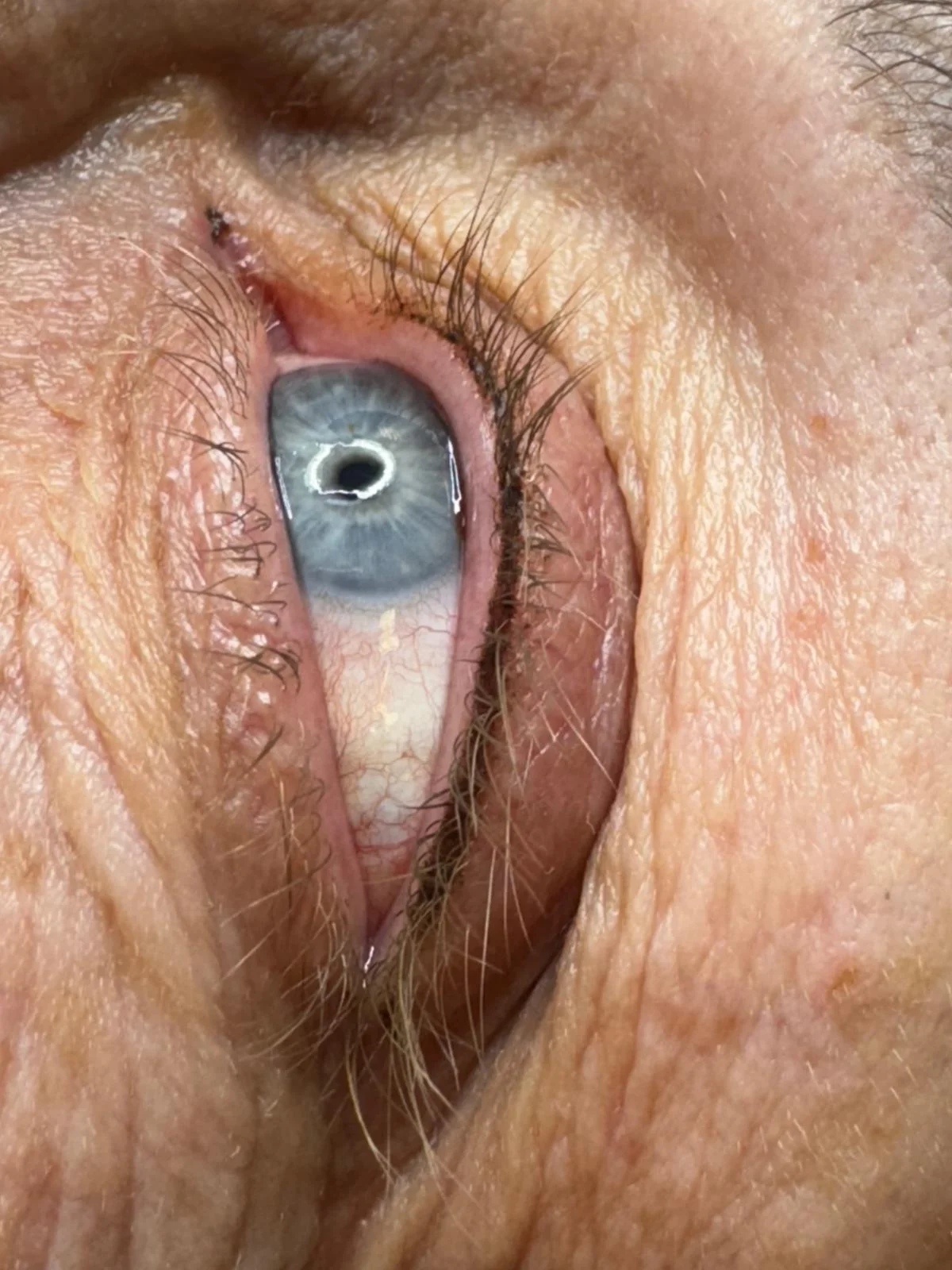 Smyslný pohled: nanesení permanentního make-upu meziřasové linky nebo pedruhové obočí