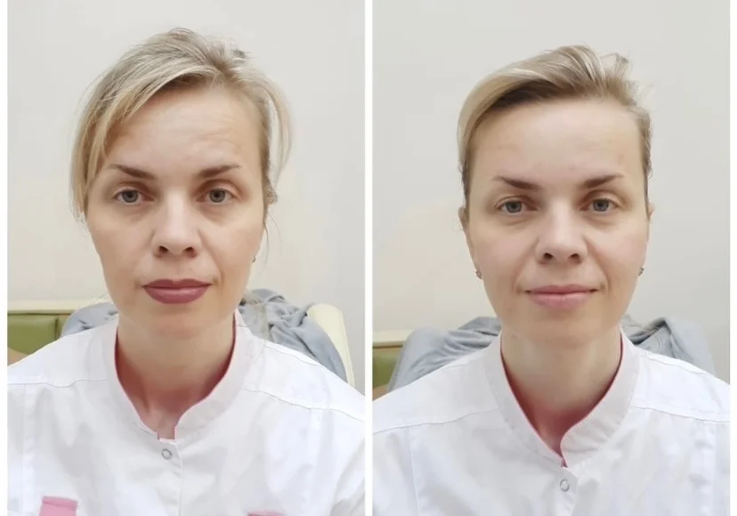 Hloubkové mechanické čistění pleti či komplexní péče o pleť a dekolt