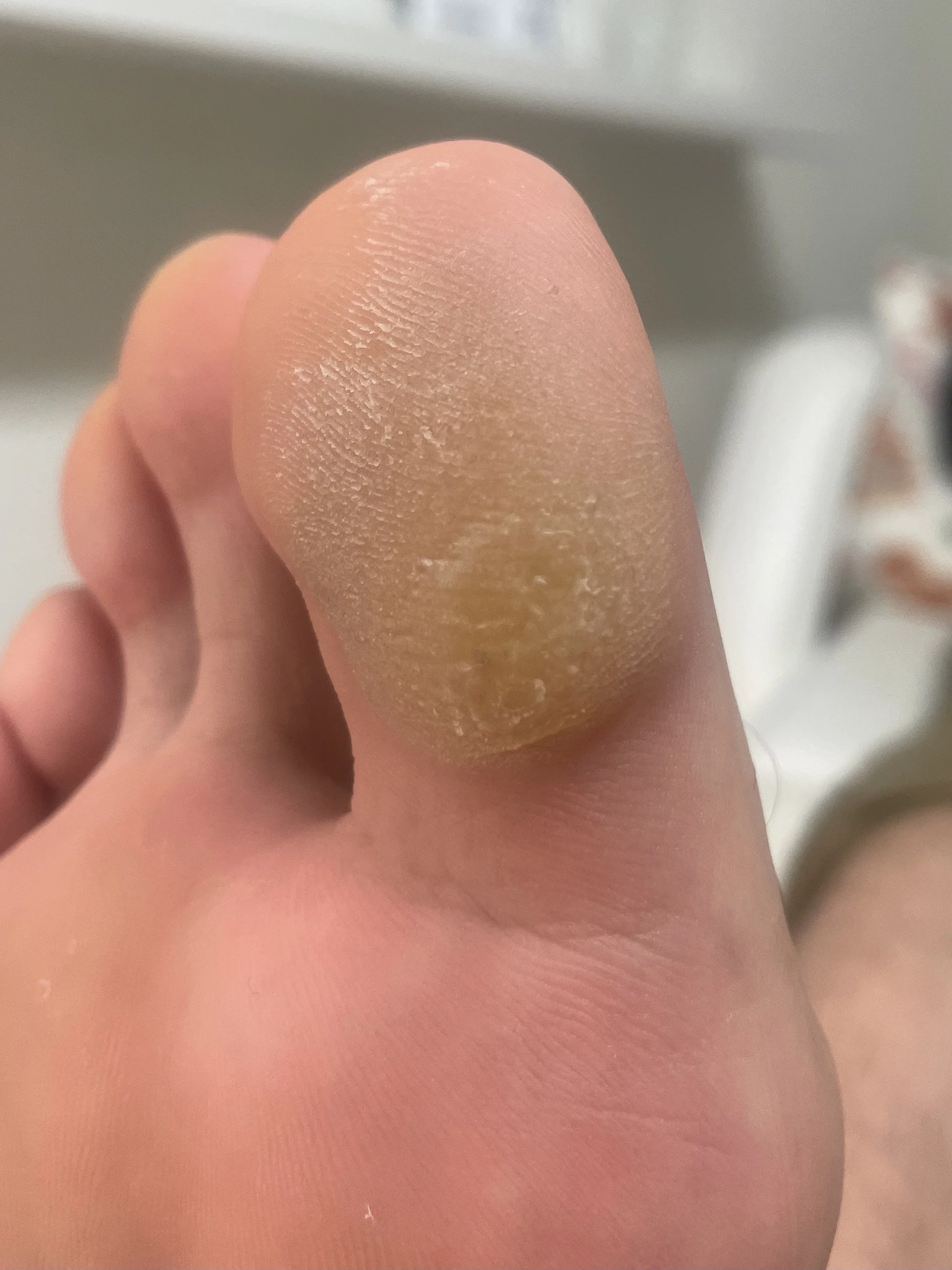 Voňavý relax pro vaše chodidla: mokrá nebo wellness pedikúra