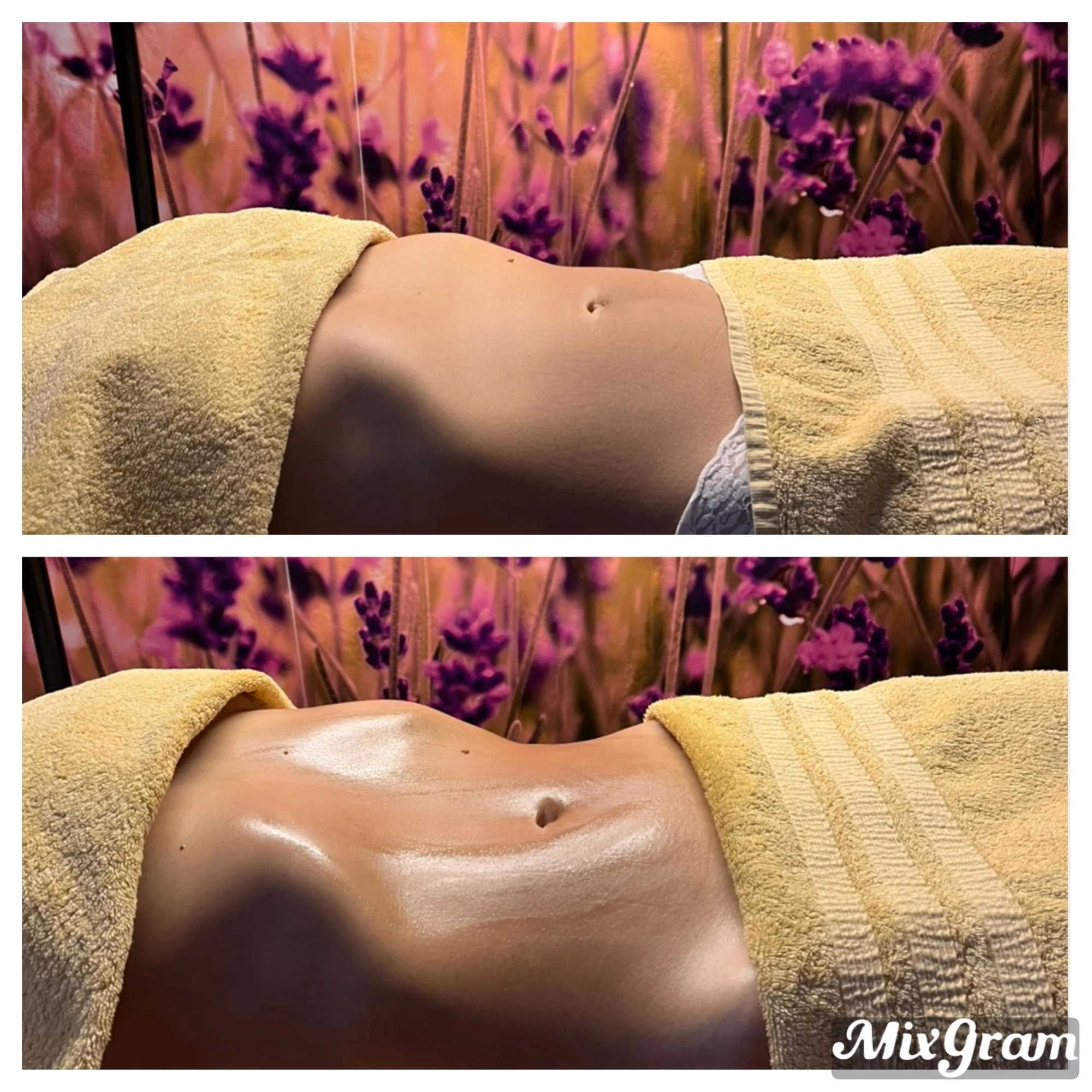 Vstříc pevné a vytvarované postavě: lymfomodelace břicha či nohou v délce 40 minut