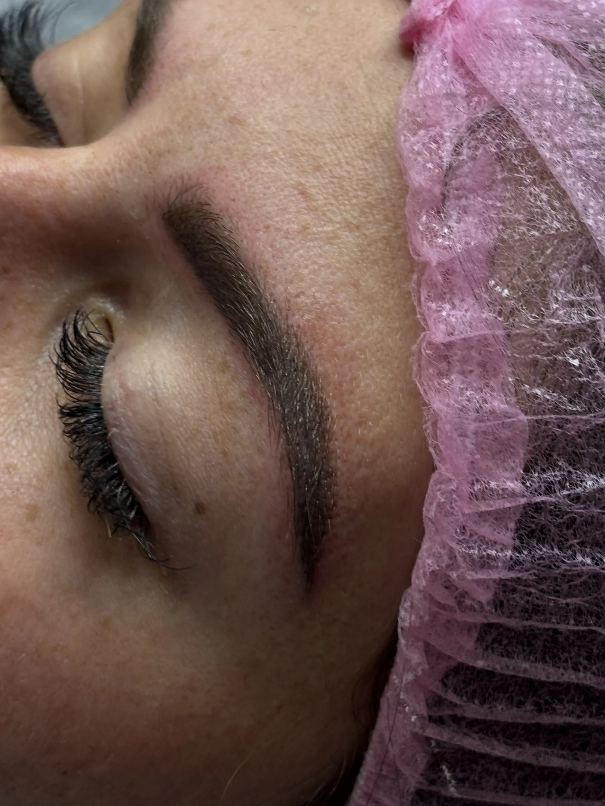 Pro zářivou pleť i dokonalé rysy: mikrojehličkování, BB Glow a permanentní make-up