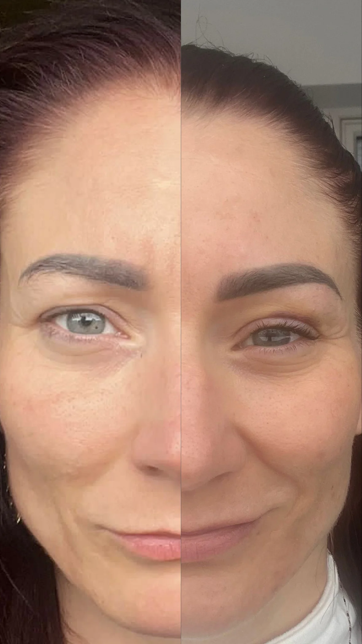 Pro zářivou pleť i dokonalé rysy: mikrojehličkování, BB Glow a permanentní make-up