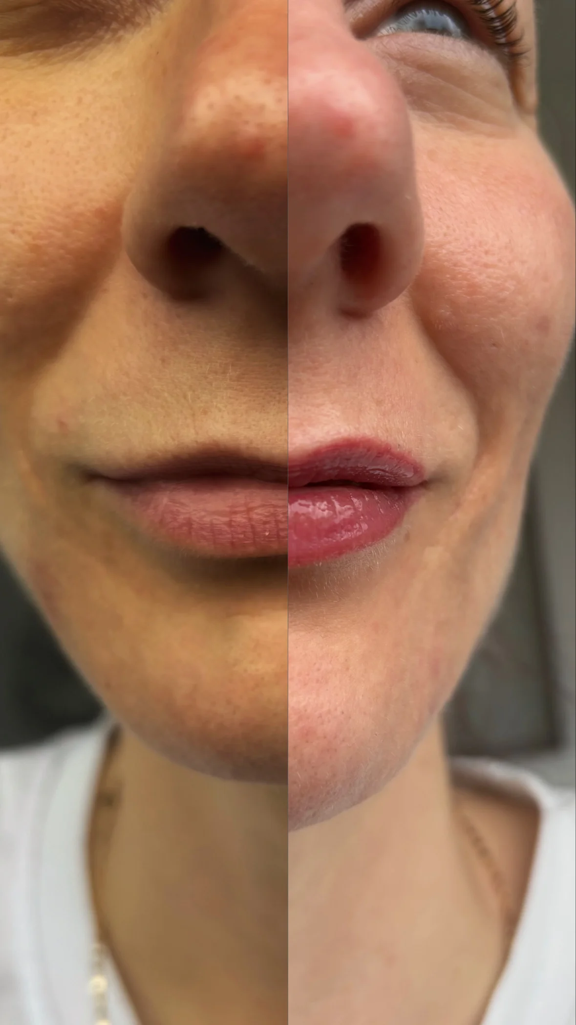 Pro zářivou pleť i dokonalé rysy: mikrojehličkování, BB Glow a permanentní make-up