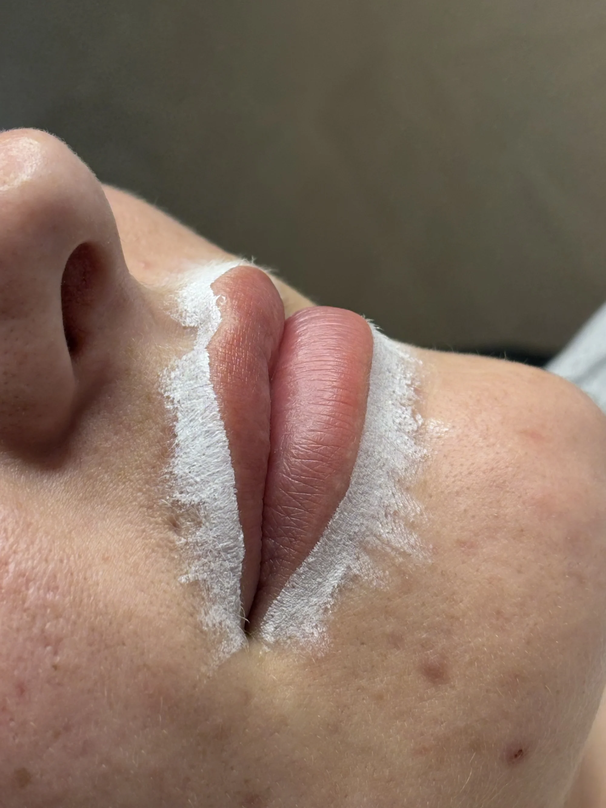 Pro zářivou pleť i dokonalé rysy: mikrojehličkování, BB Glow a permanentní make-up