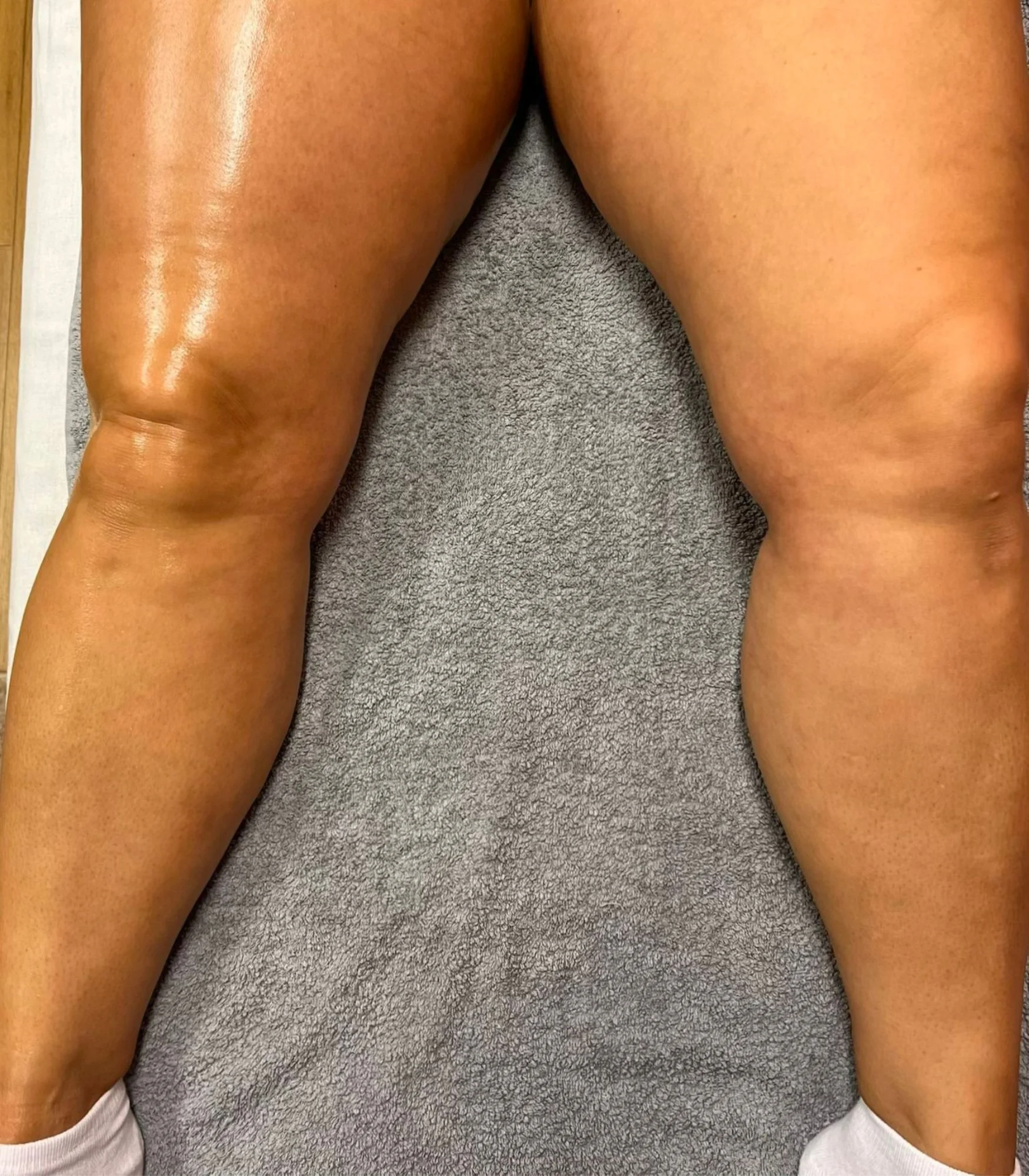 Vstříc pevné a vytvarované postavě: lymfomodelace břicha či nohou v délce 40 minut