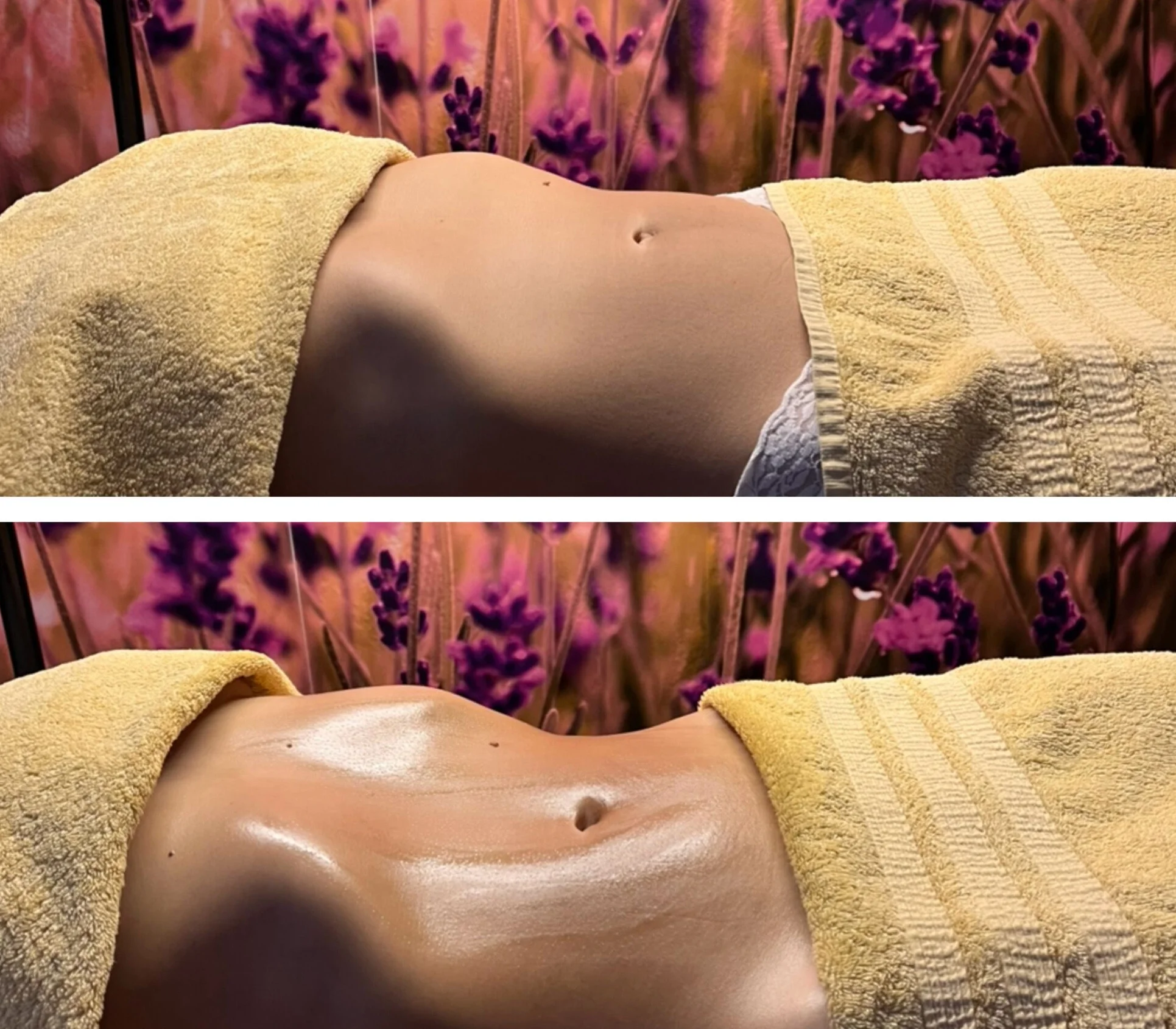 Vstříc pevné a vytvarované postavě: lymfomodelace břicha či nohou v délce 40 minut