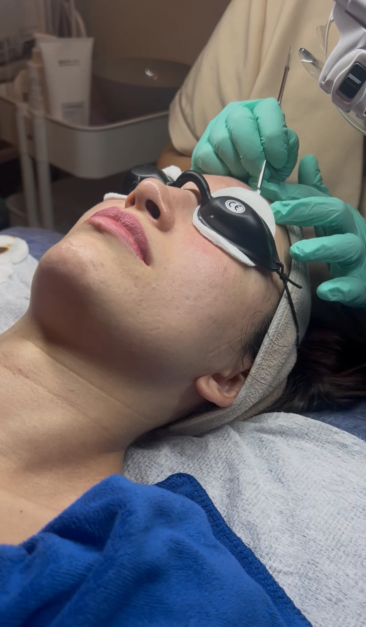 Svěží a zdravá pokožka: hloubkové čištění včetně peelingu, mikrojehličkování, korejská péče