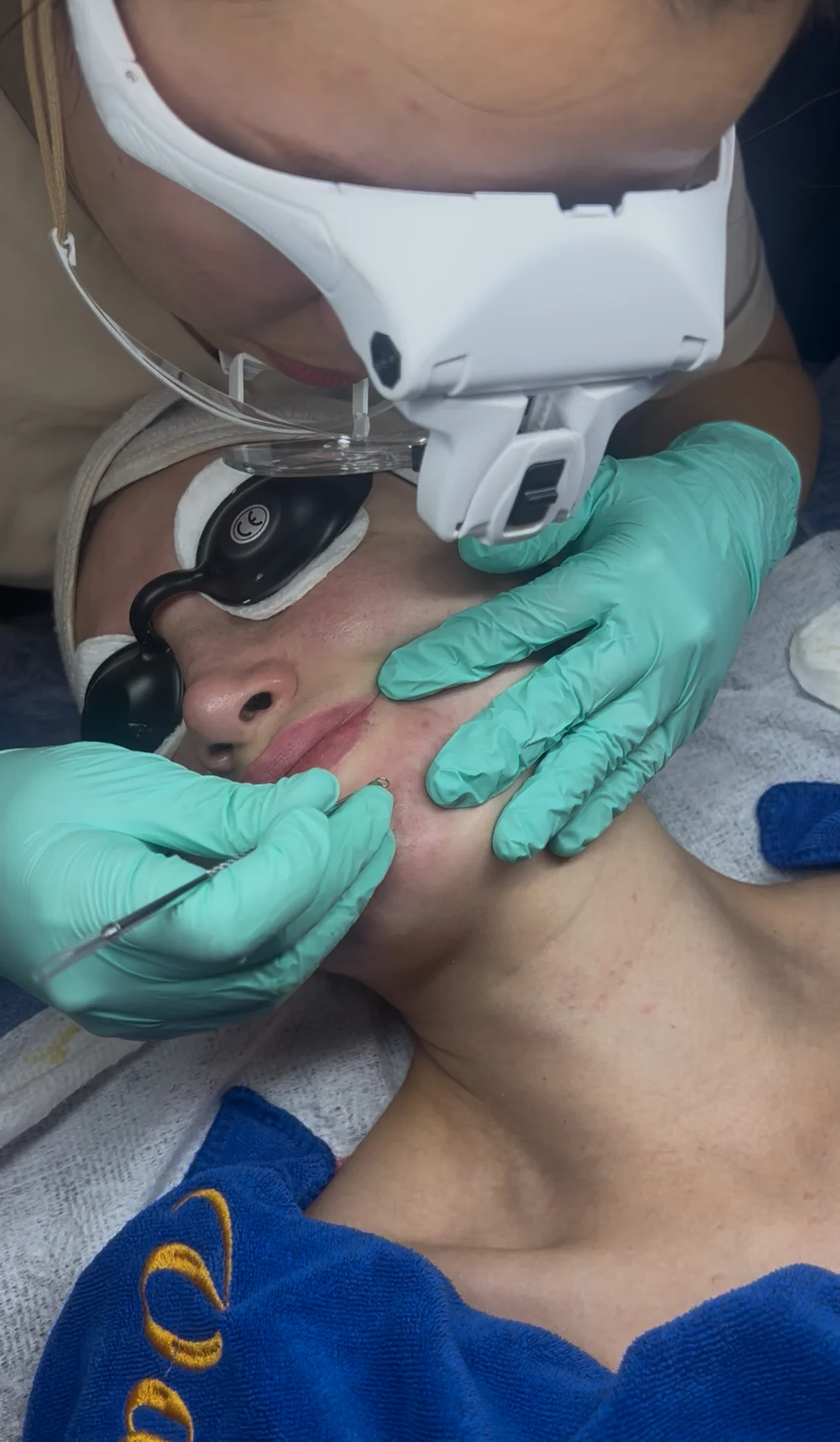 Svěží a zdravá pokožka: hloubkové čištění včetně peelingu, mikrojehličkování, korejská péče