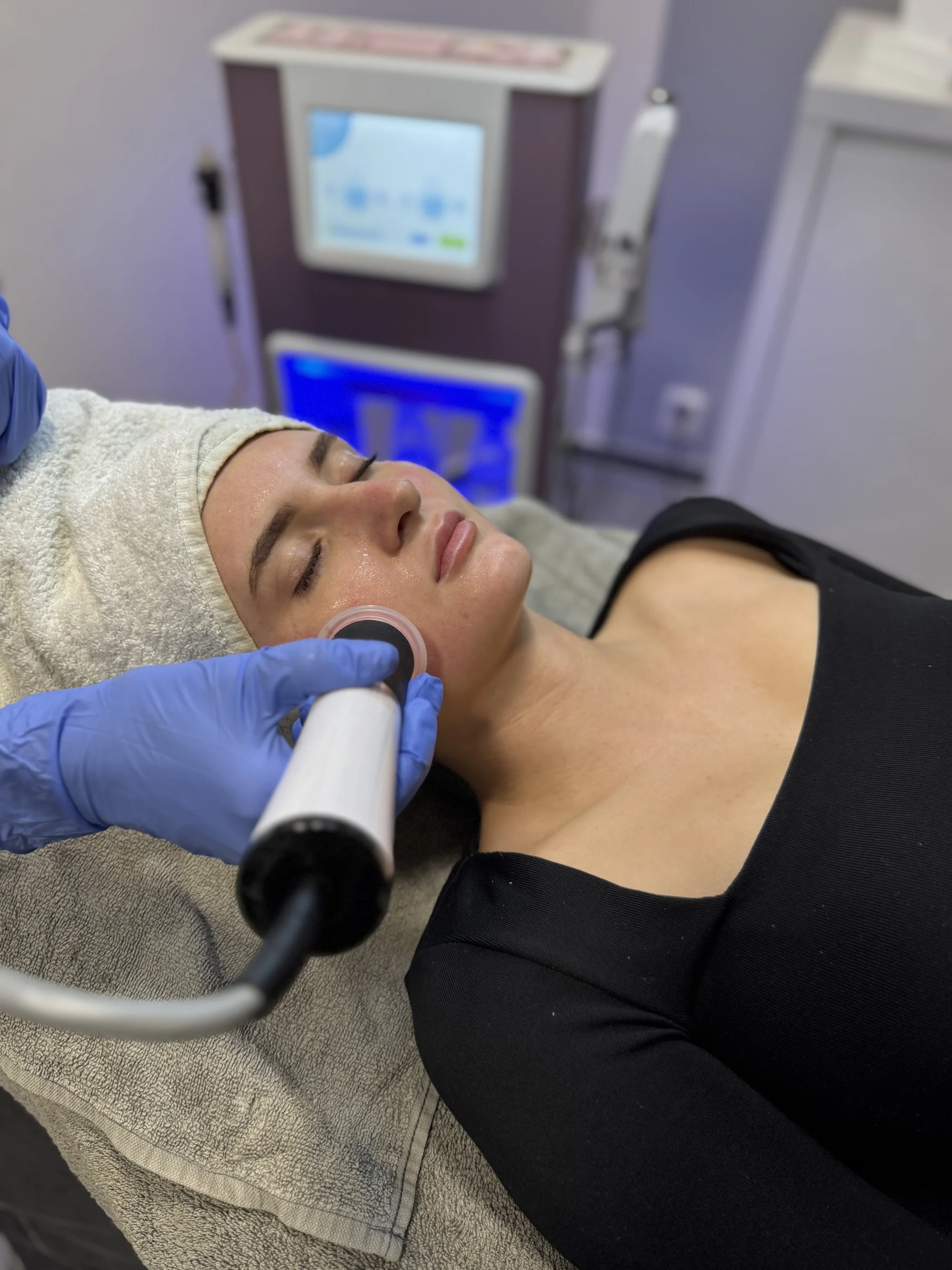 Hloubkové čištění pleti vč. oxygenoterapie a radiofrekvence, 60–90 minut