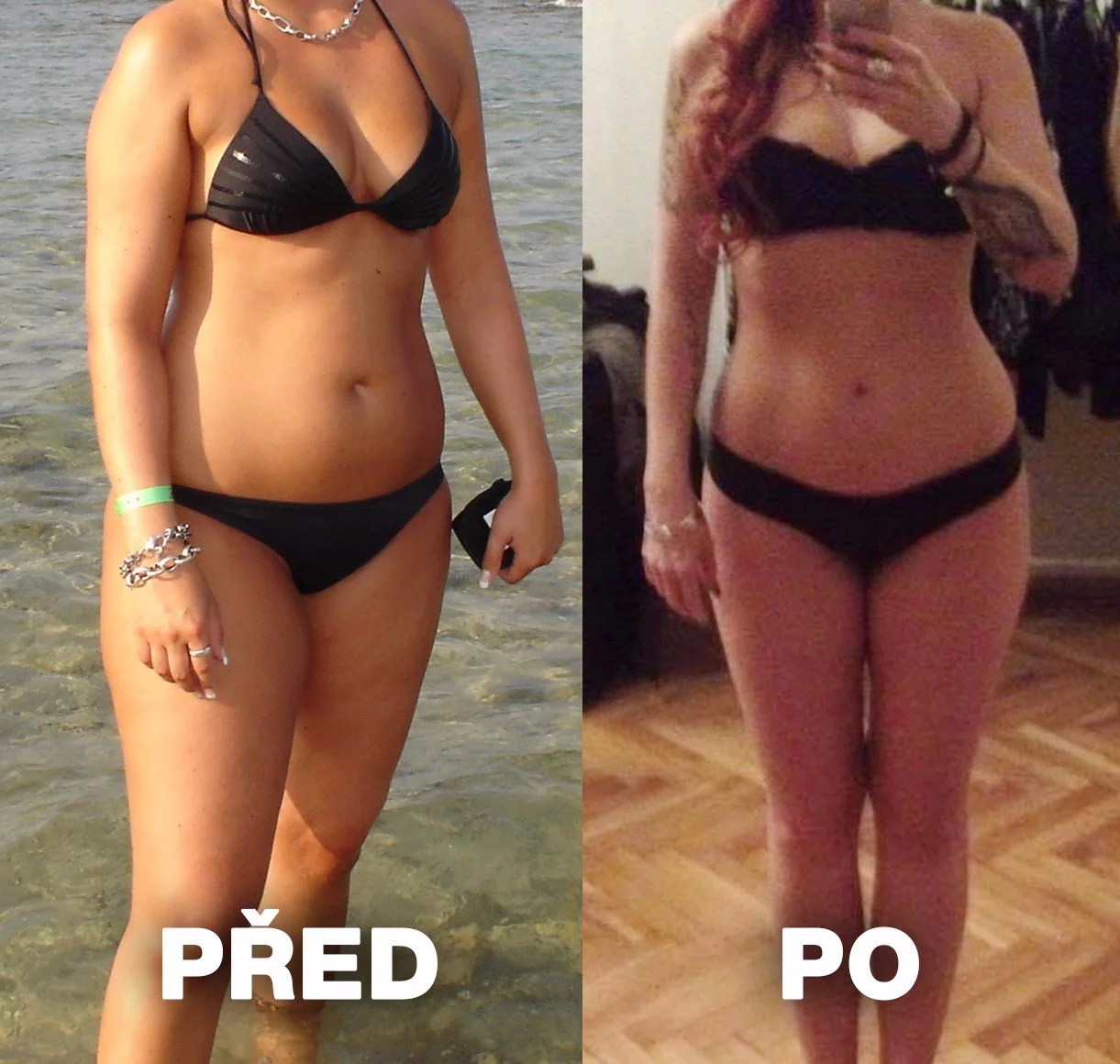 Konec přebytečným tukům a celulitidě: až 5 ošetření ultrazvukovou liposukcí a přístrojovou lymfodrenáží
