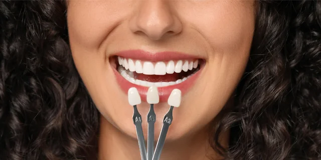 Linea Dent Poprad: Dentálna hygiena – samostatne aj v kombinácii s bielením zubov