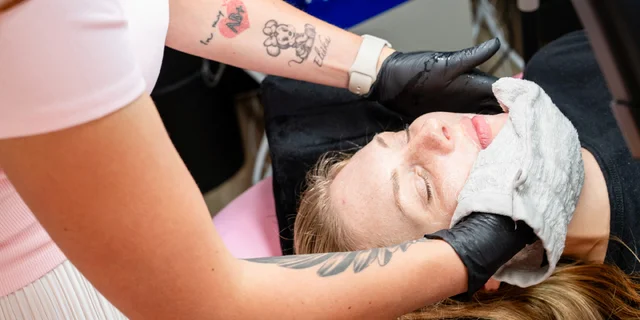 Dermaplaning, diamantová mikrodermabrázia či microneedling pomocou PDRN