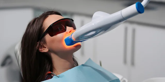 Bielenie zubov Purewhitening: kombinovaná procedúra v ambulancii aj doma