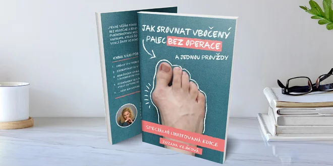 Naučte se: Jak srovnat vbočený palec bez operace