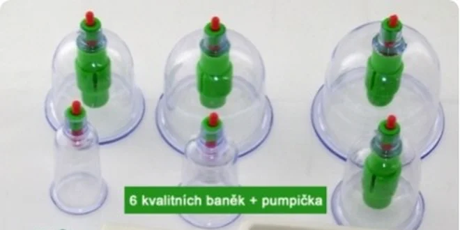 229 Kč za vakuové masážní baňky vč. pumpy - sada 6 ks v hodnotě 399 Kč