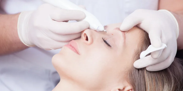 Okamžité odstranění kožních výrůstků: hemangiomů, fibrom či milií přístrojem Onetec