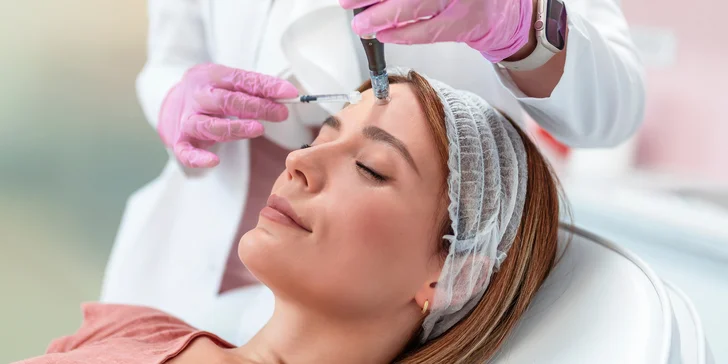 Účinná mezoterapia alebo bioregenerácia microneedling očného okolia