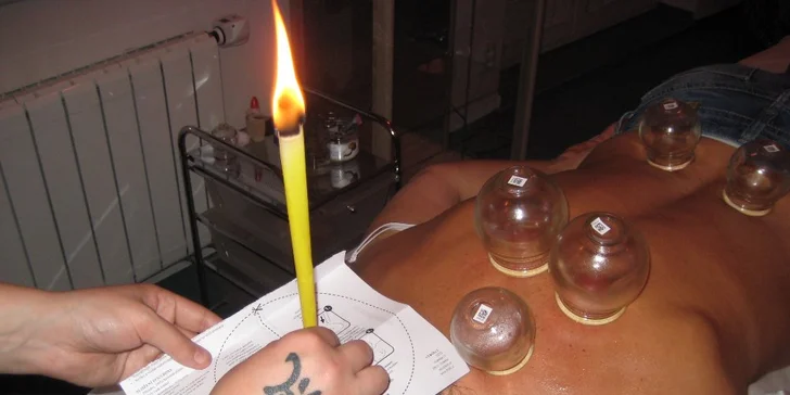 Čínská masáž kombinací metod dle potřeby: Tuina, baňky, moxování či quasha