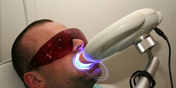 Bělení zubů laserem nejúčinnější metodou AccelaWhite z USA
