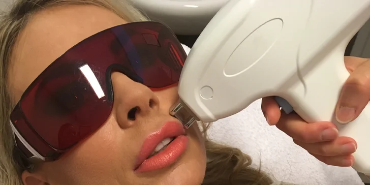 3x laserová epilace přístrojem Epília partie dle výběru