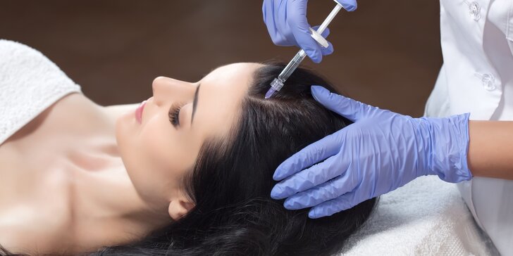Pro zdravé a husté vlasy: 1, 3 nebo 5 procedur regenerační mezoterapie