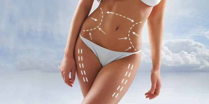 Vyzrajte na celulitidu: 1, 5 nebo 10 vstupů do VacuShape a Body Wrapping