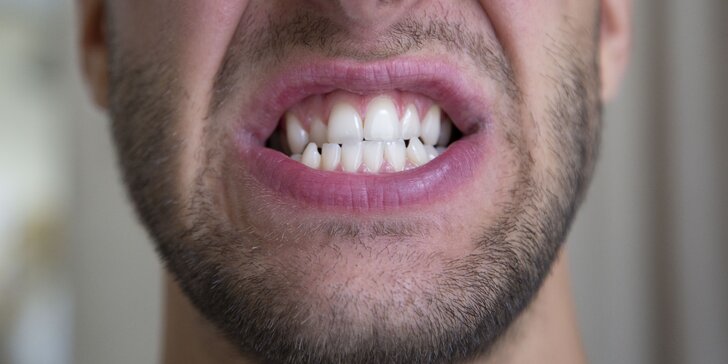 Šetrné bělení zubů s pomocí aktivního uhlí: zářivý úsměv bez peroxidu