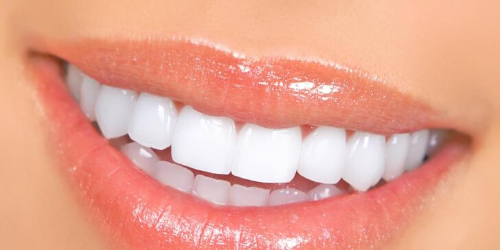 Dentální hygiena pro zářivě krásný úsměv včetně AirFlow