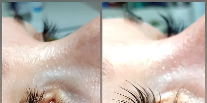 Pro smyslný pohled i bez umělých řas: lash lifting a lash botox