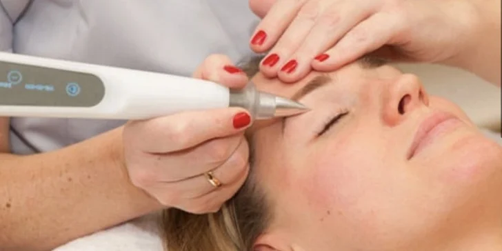 Kosmetické anti-age ošetření, kaviárová péče nebo ošetření Lift Plasma