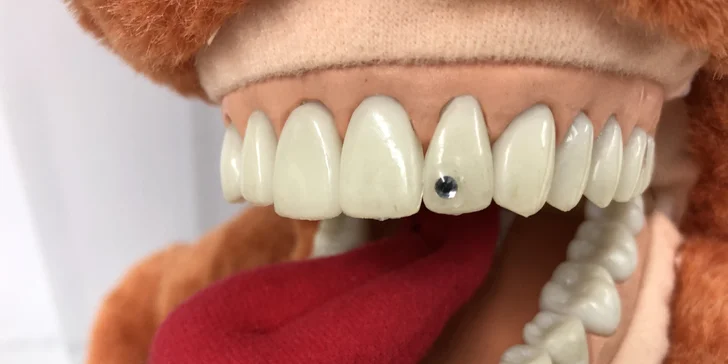Dentální hygiena s leštěním zubů i fluoridací nebo nalepení dentálního šperku