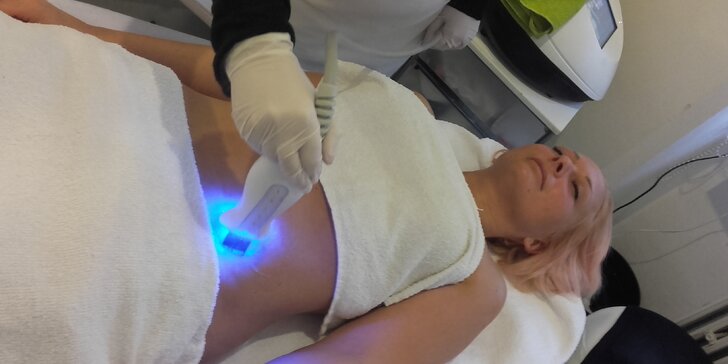 Neinvazivní liposukce modrým laserem: 1 nebo 4 ošetření