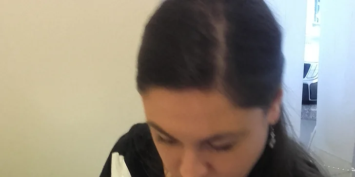 Přístrojové omlazení očního okolí a pozvednutí horních víček
