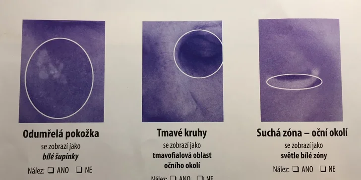Hloubková analýza pleti včetně kosmetického ošetření a denního líčení