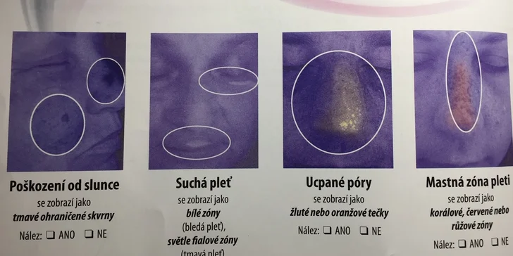 Hloubková analýza pleti včetně kosmetického ošetření a denního líčení