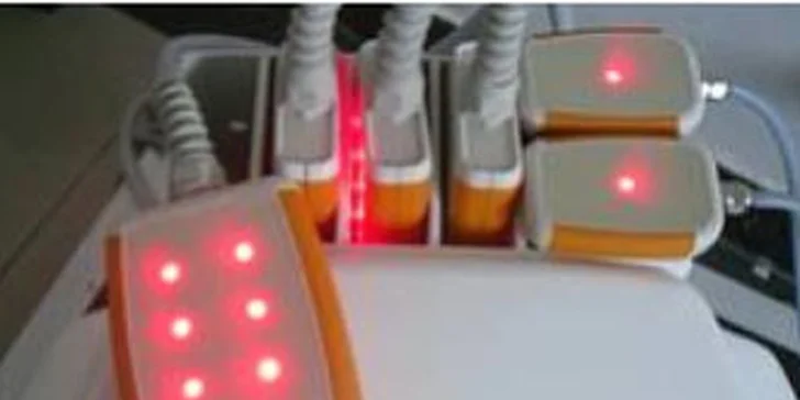 Permanentka na zeštíhlující laserovou liposukci