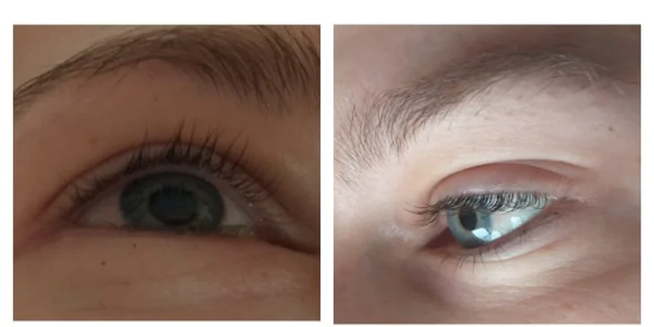 Krásné přírodní řasy: vyzkoušejte lash lifting a botox