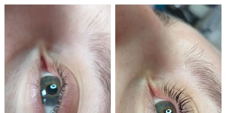 Krásné přírodní řasy: vyzkoušejte lash lifting a botox