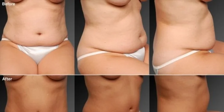 Efektivní a rychlé hubnutí v kosmické lodi - Zbavte se ihned 2 - 4kg
