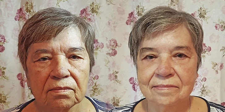 Nabité kosmetické balíčky: čištění pleti, masáž obličeje i facelifting