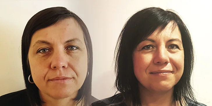Nabité kosmetické balíčky: čištění pleti, masáž obličeje i facelifting