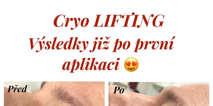 Omlazení obličeje: Cryo Lifting pro rozjasnění pleti včetně masáže obličeje