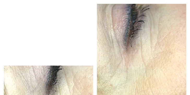 Omlazení obličeje: Cryo Lifting pro rozjasnění pleti včetně masáže obličeje