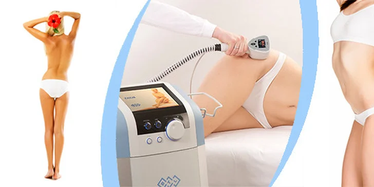 Exilis radiofrekvenční přístroj -  zpevnění a vyhlazení povadlého bříška nebo celulitidy - 4 partie
