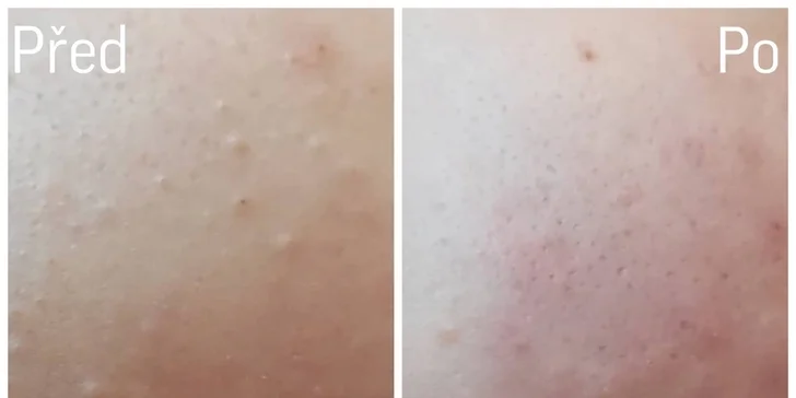 Šetrné či hloubkové manuální čištění pleti s masáží a maskou i 15% sleva na produkty